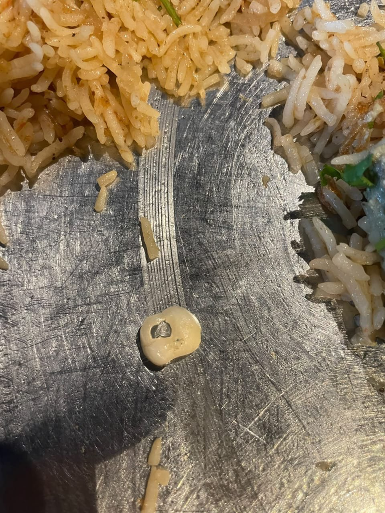 Tooth Cap Found in Mandi at Hyderabad Eatery, Food Safety Notice Served